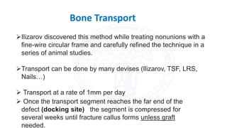 Bone Transport
Ilizarov discovered this method while treating nonunions with a
fine-wire circular frame and carefully refined the technique in a
series of animal studies.
Transport can be done by many devises (Ilizarov, TSF, LRS,
Nails…)
 Transport at a rate of 1mm per day
 Once the transport segment reaches the far end of the
defect (docking site) the segment is compressed for
several weeks until fracture callus forms unless graft
needed.
 