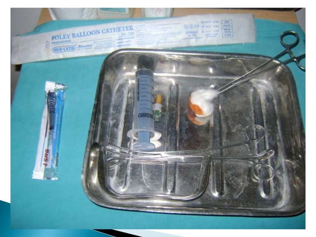 SONOSALPINGOGRAPHY STEPS BY LATE DR SAKSHI | PPT