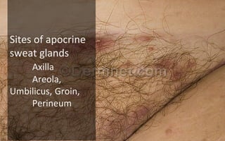 Surgical site infection | PPT