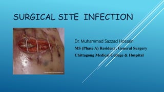 SURGICAL SITE INFECTION
Dr. Muhammad Sazzad Hossain
MS (Phase A) Resident , General Surgery
Chittagong Medical College & Hospital
 