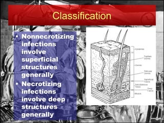 Surgical Site Infections 2025: approach and management | PPT