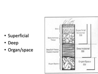 • Superficial
• Deep
• Organ/space
 