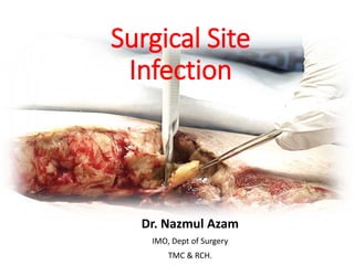 Surgical Site
Infection
Dr. Nazmul Azam
IMO, Dept of Surgery
TMC & RCH.
 