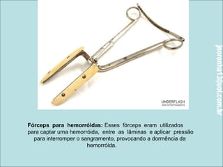 Fórceps para hemorróidas: Esses fórceps eram utilizados 
para captar uma hemorróida, entre as lâminas e aplicar pressão 
para interromper o sangramento, provocando a dormência da 
hemorróida. 
 