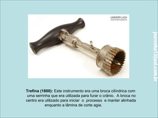 Trefina (1800): Este instrumento era uma broca cilíndrica com 
uma serrinha que era utilizada para furar o crânio. A broca no 
centro era utilizado para iniciar o processo e manter alinhada 
enquanto a lâmina de corte agia. 
 
