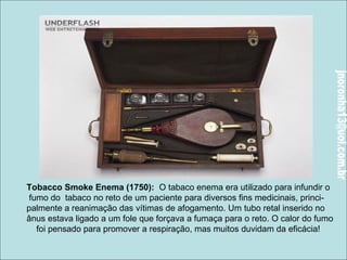 Tobacco Smoke Enema (1750): O tabaco enema era utilizado para infundir o 
fumo do tabaco no reto de um paciente para diversos fins medicinais, princi-palmente 
a reanimação das vítimas de afogamento. Um tubo retal inserido no 
ânus estava ligado a um fole que forçava a fumaça para o reto. O calor do fumo 
foi pensado para promover a respiração, mas muitos duvidam da eficácia! 
 