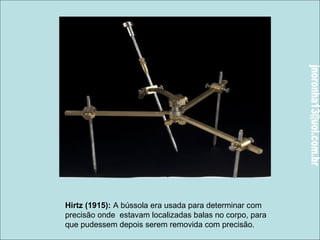 Hirtz (1915): A bússola era usada para determinar com 
precisão onde estavam localizadas balas no corpo, para 
que pudessem depois serem removida com precisão. 
 