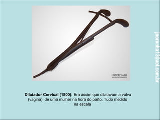 Dilatador Cervical (1800): Era assim que dilatavam a vulva 
(vagina) de uma mulher na hora do parto. Tudo medido 
na escala 
 