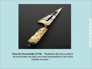 Faca de Circuncisão (1770) Realizado até hoje,a prática 
da circuncisão era feita com esse brinquedinho aí em cima. 
Coitado do pinto ! 
 
