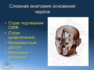 Сложная анатомия основания
                 черепа

•  Страх подтекания
   СМЖ
•  Страх
   кровотечения
•  Неадекватный
   доступ
•  Неполные
   резекции
2012
 