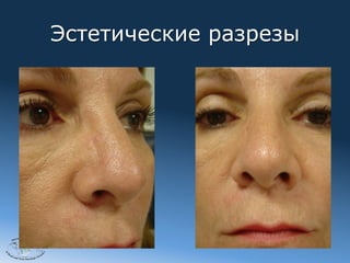 Эстетические разрезы




2012
 