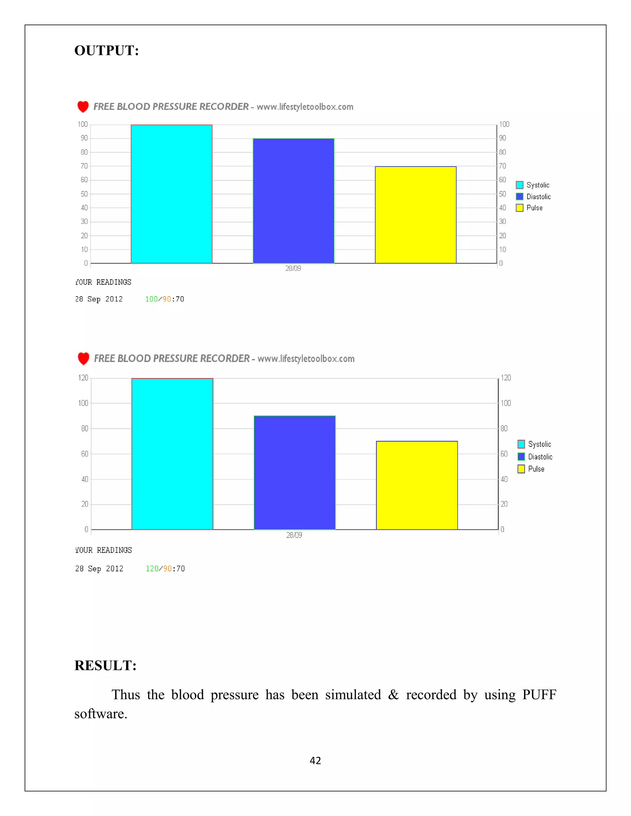OUTPUT:

RESULT:
Thus the blood pressure has been simulated & recorded by using PUFF
software.
42

 