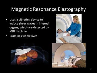 Magnetic Resonance Elastography
• Uses a vibrating device to
induce shear waves in internal
organs, which are detected by
MRI machine
• Examines whole liver

11

 