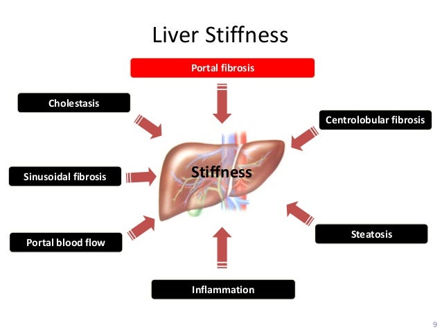 detecting early liver fibrosis a nutshell for primary care liver stiffness chart