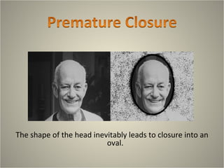 The shape of the head inevitably leads to closure into an
                          oval.
 