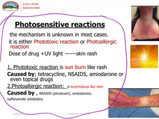 Photosensitive Rash Pcds Sss.pdf drug reactions in dermstology reactions | PDF