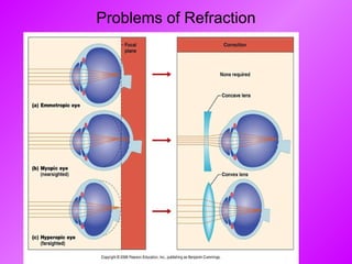 Problems of Refraction 