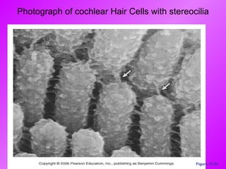 Photograph of cochlear Hair Cells with stereocilia Figure 15.33 