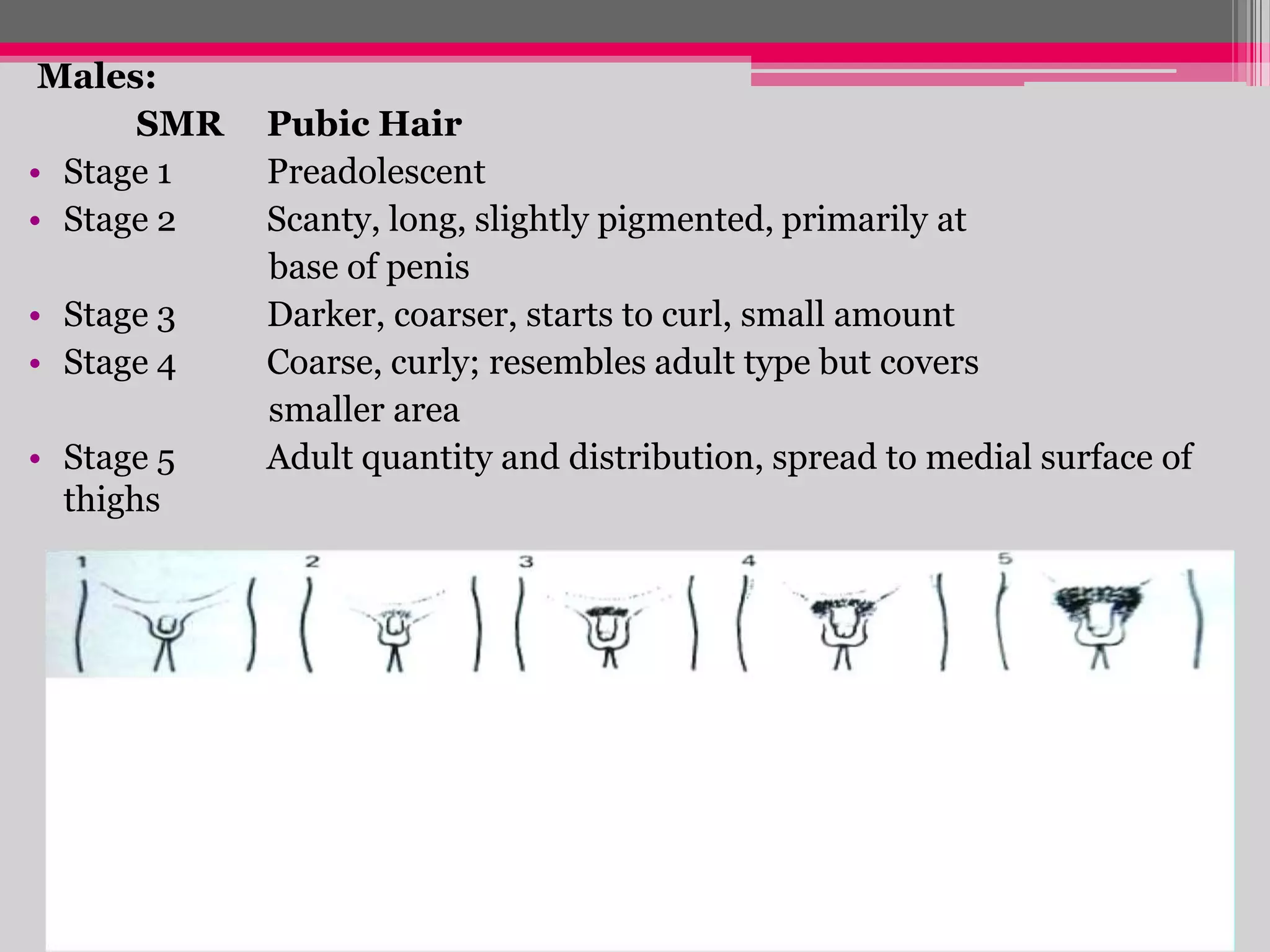Males:
SMR
• Stage 1
• Stage 2
• Stage 3
• Stage 4
• Stage 5
thighs

Pubic Hair
Preadolescent
Scanty, long, slightly pigmented, primarily at
base of penis
Darker, coarser, starts to curl, small amount
Coarse, curly; resembles adult type but covers
smaller area
Adult quantity and distribution, spread to medial surface of

 