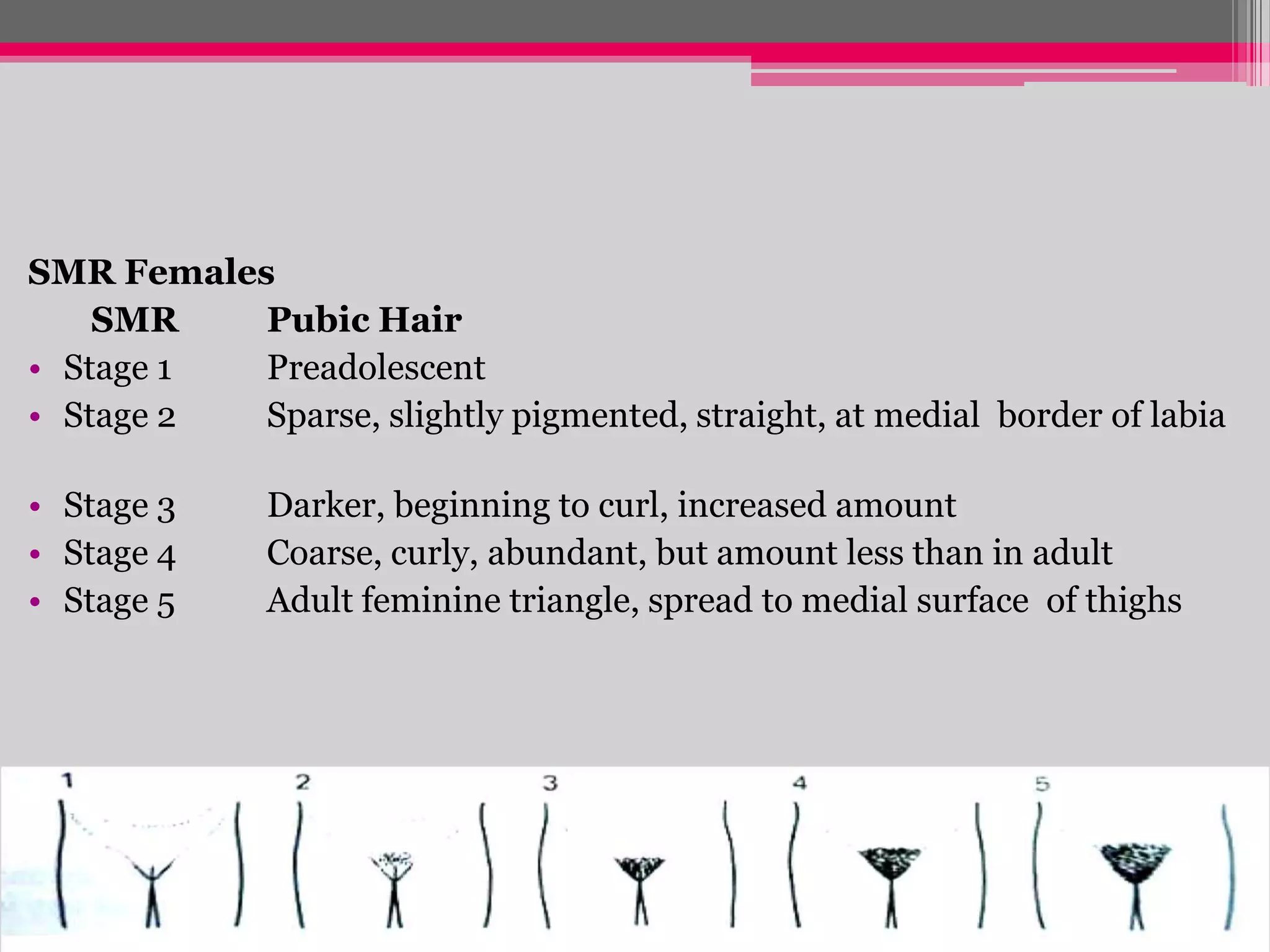 SMR Females
SMR
Pubic Hair
• Stage 1
Preadolescent
• Stage 2
Sparse, slightly pigmented, straight, at medial border of labia

• Stage 3
• Stage 4
• Stage 5

Darker, beginning to curl, increased amount
Coarse, curly, abundant, but amount less than in adult
Adult feminine triangle, spread to medial surface of thighs

 