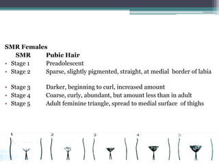 SMR Females
SMR
Pubic Hair
• Stage 1
Preadolescent
• Stage 2
Sparse, slightly pigmented, straight, at medial border of labia

• Stage 3
• Stage 4
• Stage 5

Darker, beginning to curl, increased amount
Coarse, curly, abundant, but amount less than in adult
Adult feminine triangle, spread to medial surface of thighs

 