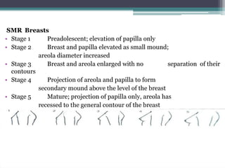 SMR Breasts
• Stage 1
Preadolescent; elevation of papilla only
• Stage 2
Breast and papilla elevated as small mound;
areola diameter increased
• Stage 3
Breast and areola enlarged with no
separation of their
contours
• Stage 4
Projection of areola and papilla to form
secondary mound above the level of the breast
• Stage 5
Mature; projection of papilla only, areola has
recessed to the general contour of the breast

 