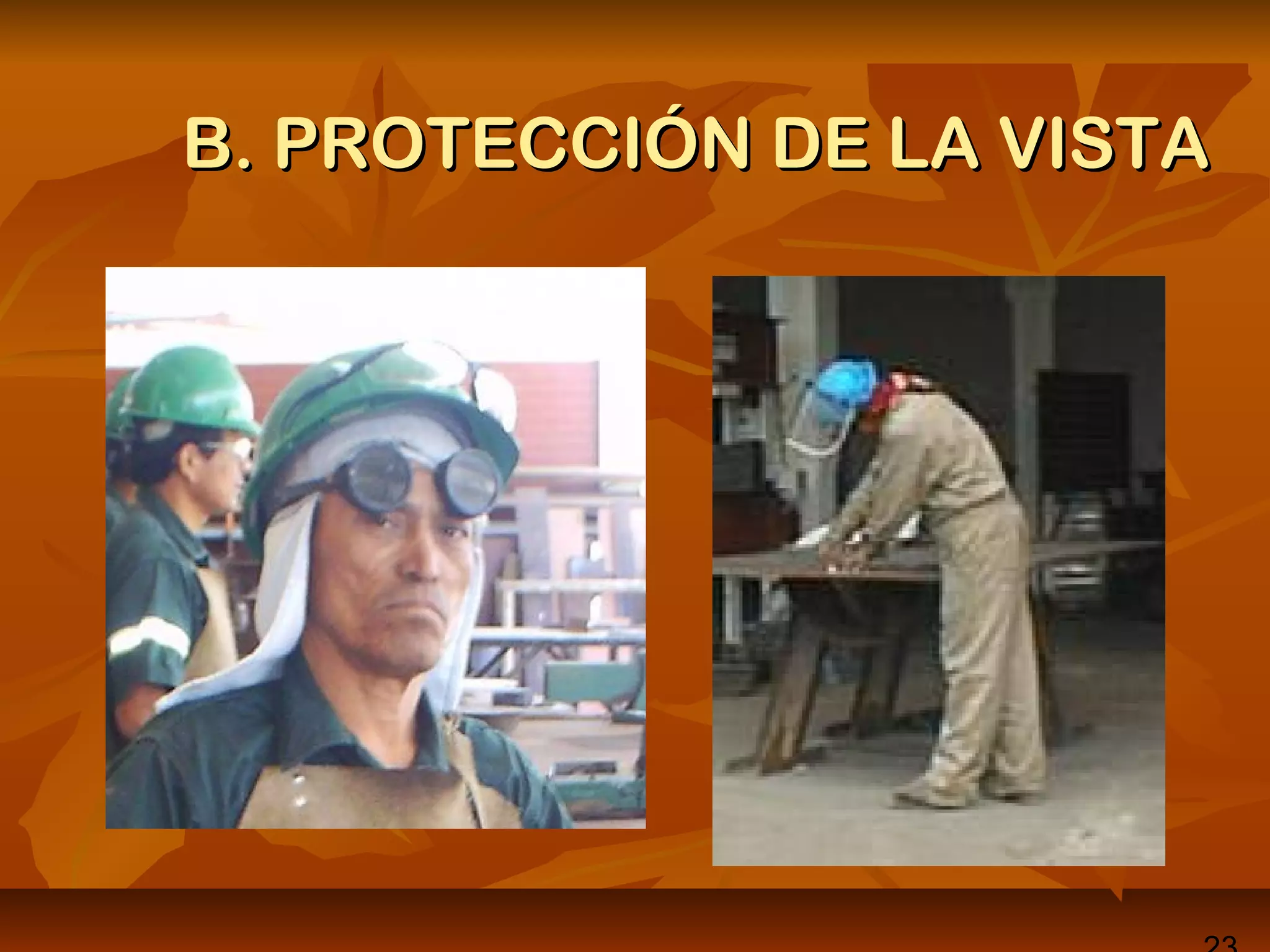 B. PROTECCIÓN DE LA VISTAB. PROTECCIÓN DE LA VISTA
 