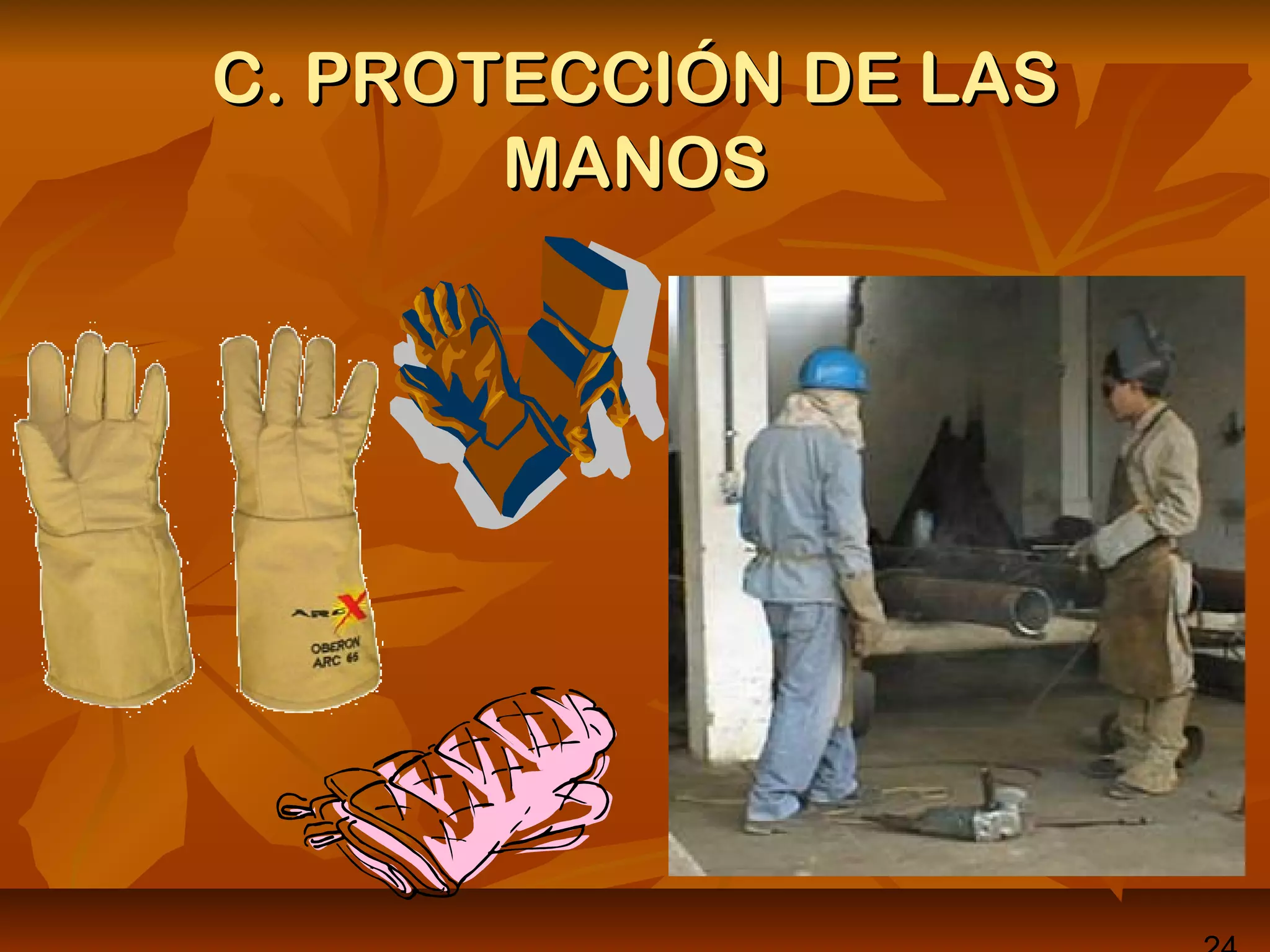 C. PROTECCIÓN DE LASC. PROTECCIÓN DE LAS
MANOSMANOS
 