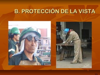 B. PROTECCIÓN DE LA VISTAB. PROTECCIÓN DE LA VISTA
 