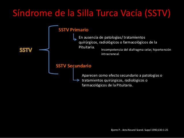 silla turca vacia s 237 ndrome silla turca vac 237 a silla turca vacia s 237 ndrome silla turca vac 237 a