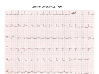 Lerchner Josef, 07.09.1966
 