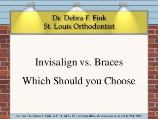 Invisalign vs. Braces 
Which Should you Choose 
 