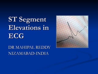 ST Segment Elevations in ECG DR MAHIPAL REDDY NIZAMABAD-INDIA 