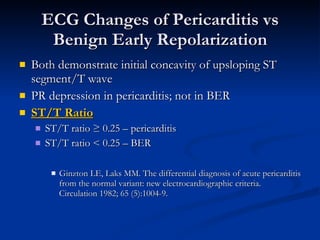 Both demonstrate initial concavity of upsloping ST segment/T wave PR depression in pericarditis; not in BER ST/T Ratio ST/T ratio ≥ 0.25 – pericarditis  ST/T ratio < 0.25 – BER Ginzton LE, Laks MM. The differential diagnosis of acute pericarditis from the normal variant: new electrocardiographic criteria. Circulation 1982; 65 (5):1004-9. ECG Changes of Pericarditis vs Benign Early Repolarization 