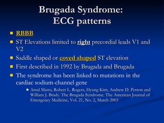 Brugada Syndrome:  ECG patterns RBBB ST Elevations limited to  right  precordial leads V1 and V2 Saddle shaped or  coved shaped  ST elevation First described in 1992 by Brugada and Brugada The syndrome has been linked to mutations in the cardiac sodium-channel gene Amal Mattu, Robert L. Rogers, Hyung Kim, Andrew D. Perron and William J. Brady. The Brugada Syndrome. The American Journal of Emergency Medicine, Vol. 21, No. 2, March 2003 