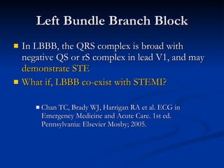 Left Bundle Branch Block In LBBB, the QRS complex is broad with negative QS or rS complex in lead V1, and may  demonstrate STE What if, LBBB co-exist with STEMI? Chan TC, Brady WJ, Harrigan RA et al. ECG in Emergency Medicine and Acute Care. 1st ed. Pennsylvania: Elsevier Mosby; 2005. 