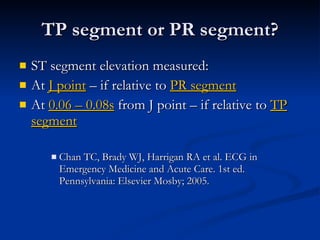 ST segment elevation measured: At  J point  – if relative to  PR segment At  0.06 – 0.08s  from J point – if relative to  TP segment Chan TC, Brady WJ, Harrigan RA et al. ECG in Emergency Medicine and Acute Care. 1st ed. Pennsylvania: Elsevier Mosby; 2005. TP segment or PR segment? 