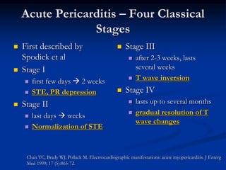 Acute Pericarditis – Four Classical
Stages
 First described by
Spodick et al
 Stage I
 first few days  2 weeks
 STE, PR depression
 Stage II
 last days  weeks
 Normalization of STE
 Stage III
 after 2-3 weeks, lasts
several weeks
 T wave inversion
 Stage IV
 lasts up to several months
 gradual resolution of T
wave changes
Chan TC, Brady WJ, Pollack M. Electrocardiographic manifestations: acute myopericarditis. J Emerg
Med 1999; 17 (5):865-72.
 