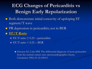  Both demonstrate initial concavity of upsloping ST
segment/T wave
 PR depression in pericarditis; not in BER
 ST/T Ratio
 ST/T ratio ≥ 0.25 – pericarditis
 ST/T ratio < 0.25 – BER
 Ginzton LE, Laks MM. The differential diagnosis of acute pericarditis
from the normal variant: new electrocardiographic criteria.
Circulation 1982; 65 (5):1004-9.
ECG Changes of Pericarditis vs
Benign Early Repolarization
 