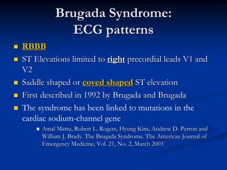 Brugada Syndrome:
ECG patterns
 RBBB
 ST Elevations limited to right precordial leads V1 and
V2
 Saddle shaped or coved shaped ST elevation
 First described in 1992 by Brugada and Brugada
 The syndrome has been linked to mutations in the
cardiac sodium-channel gene
 Amal Mattu, Robert L. Rogers, Hyung Kim, Andrew D. Perron and
William J. Brady. The Brugada Syndrome. The American Journal of
Emergency Medicine, Vol. 21, No. 2, March 2003
 