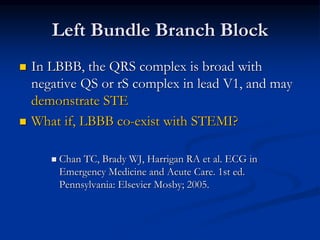 Left Bundle Branch Block
 In LBBB, the QRS complex is broad with
negative QS or rS complex in lead V1, and may
demonstrate STE
 What if, LBBB co-exist with STEMI?
 Chan TC, Brady WJ, Harrigan RA et al. ECG in
Emergency Medicine and Acute Care. 1st ed.
Pennsylvania: Elsevier Mosby; 2005.
 