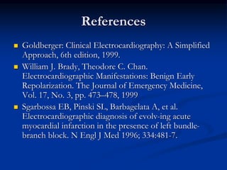 References
 Goldberger: Clinical Electrocardiography: A Simplified
Approach, 6th edition, 1999.
 William J. Brady, Theodore C. Chan.
Electrocardiographic Manifestations: Benign Early
Repolarization. The Journal of Emergency Medicine,
Vol. 17, No. 3, pp. 473–478, 1999
 Sgarbossa EB, Pinski SL, Barbagelata A, et al.
Electrocardiographic diagnosis of evolv-ing acute
myocardial infarction in the presence of left bundle-
branch block. N Engl J Med 1996; 334:481-7.
 