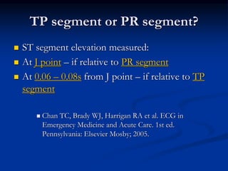  ST segment elevation measured:
 At J point – if relative to PR segment
 At 0.06 – 0.08s from J point – if relative to TP
segment
 Chan TC, Brady WJ, Harrigan RA et al. ECG in
Emergency Medicine and Acute Care. 1st ed.
Pennsylvania: Elsevier Mosby; 2005.
TP segment or PR segment?
 