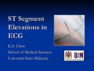 ST Segment Elevations in ECG K.S. Chew School of Medical Sciences Universiti Sains Malaysia 