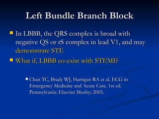 Left Bundle Branch Block <ul><li>In LBBB, the QRS complex is broad with negative QS or rS complex in lead V1, and may  dem...