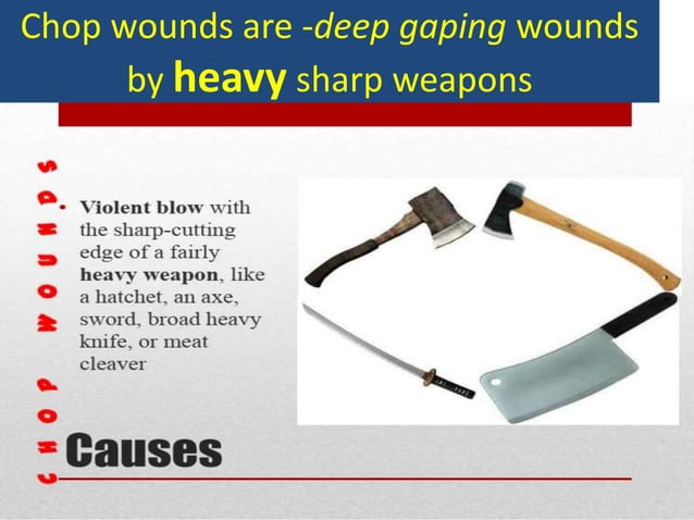 Stab and chop wounds mb singh 2020 | PPTX | First Aid | Injuries
