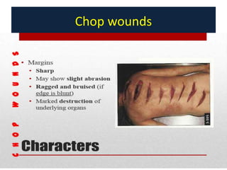 Stab and chop wounds mb singh 2020 | PPT