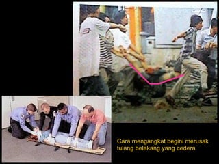 Cara mengangkat begini merusak  tulang belakang yang cedera 