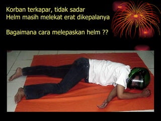 Korban terkapar, tidak sadar Helm masih melekat erat dikepalanya Bagaimana cara melepaskan helm ?? 