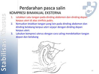 10 
Perdarahan pasca salin 
KOMPRESI BIMANUAL EKSTERNA 
1. Letakkan satu tangan pada dinding abdomen dan dinding depan 
korpus uteri di atas simfisis pubis. 
2. Kemudian letakkan tangan yang lain pada dinding abdomen dan 
dinding belakang korpus uteri sejajar dengan dinding depan 
korpus uteri. 
3. Lakukan kompresi uterus dengan cara saling mendekatkan tangan 
depan dan belakang 
 